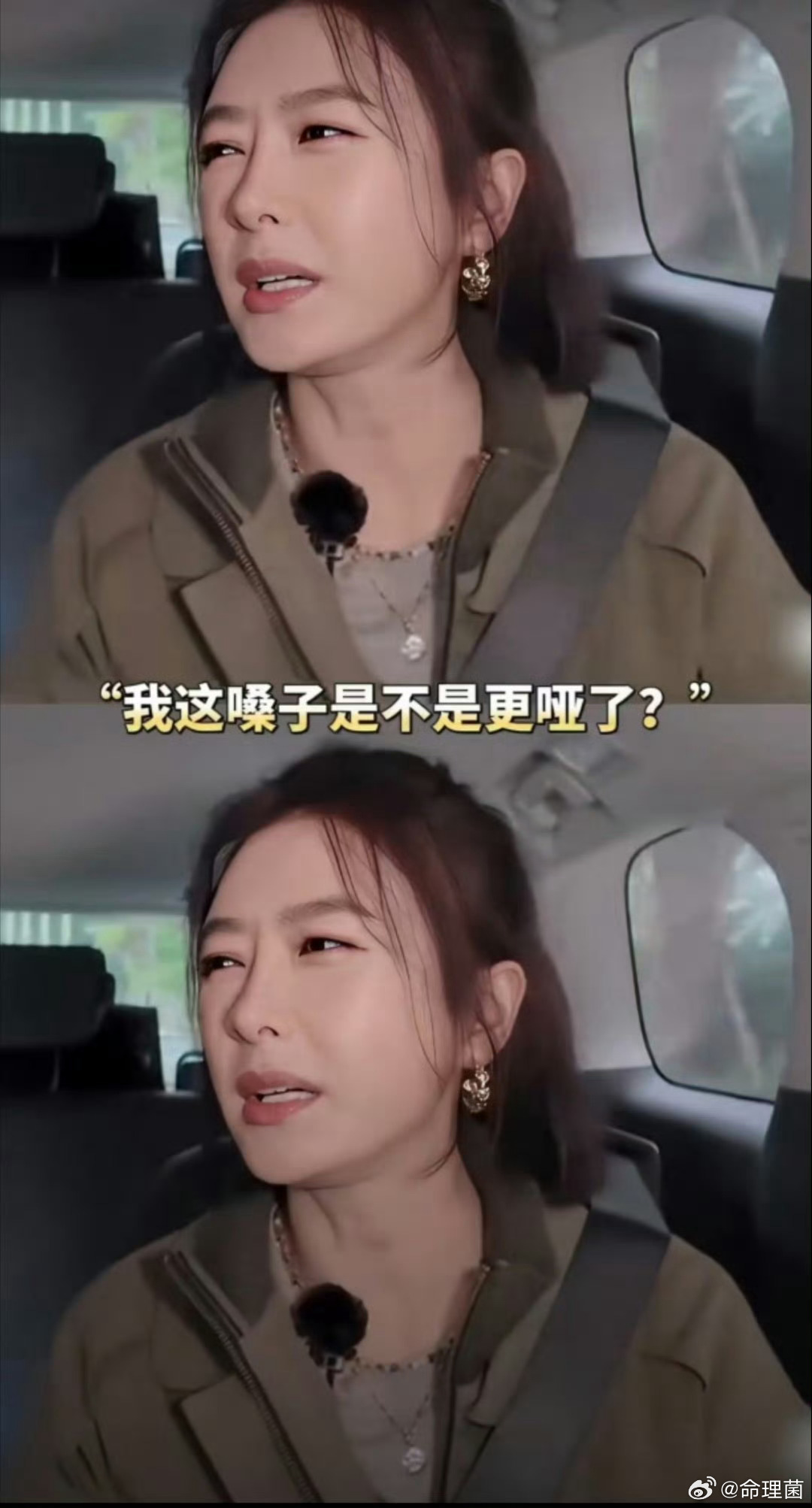 秦岚嗓子哑了三年为啥会这样呢 不过哑嗓也很有魅力 