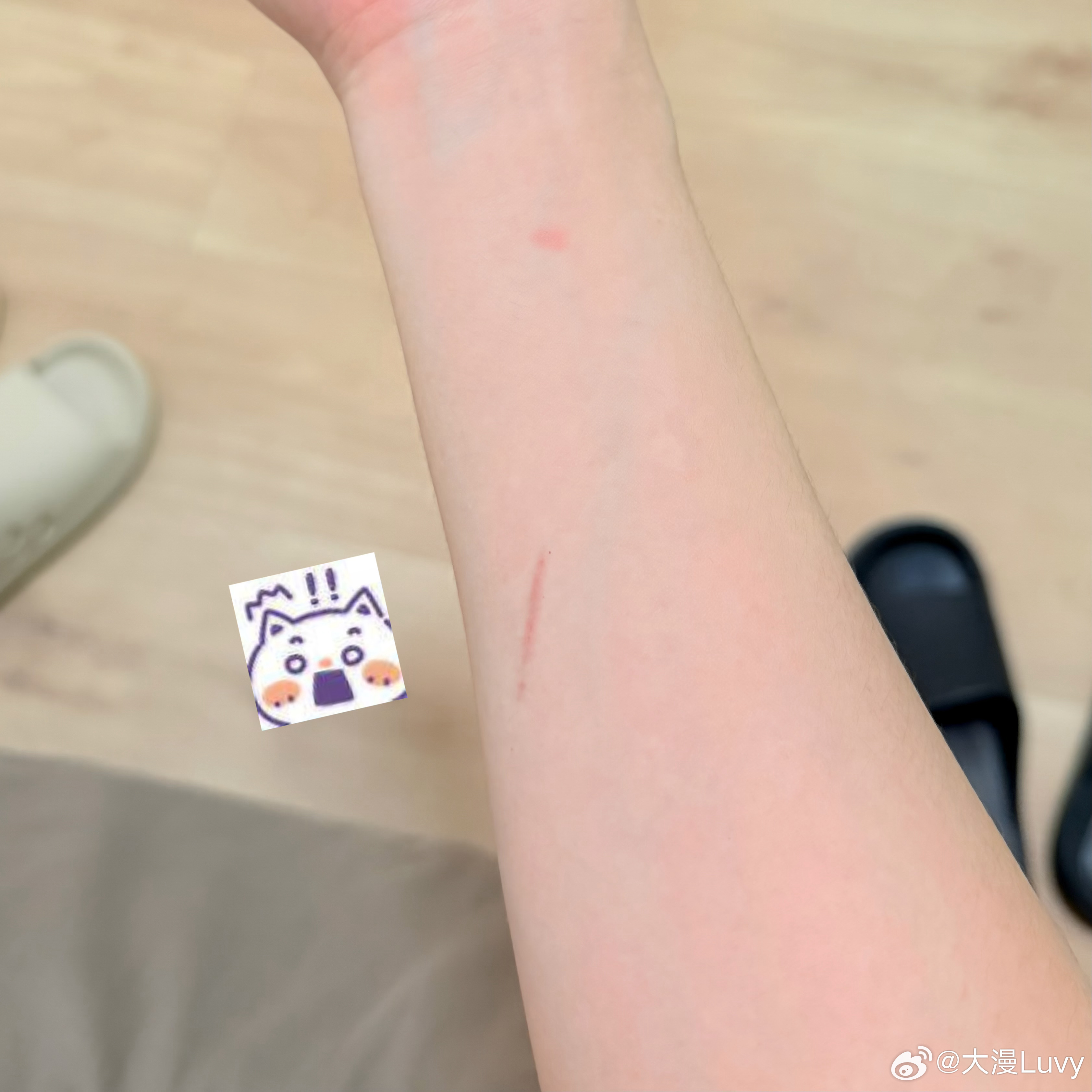 真的很猛吗？小源说这是我昨晚弄伤的，咋不信呢