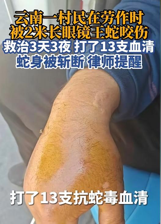 锄头落下那一刻，死神已上线！5月24日报道，云南大哥砍断2米眼镜王蛇，蛇身断成两