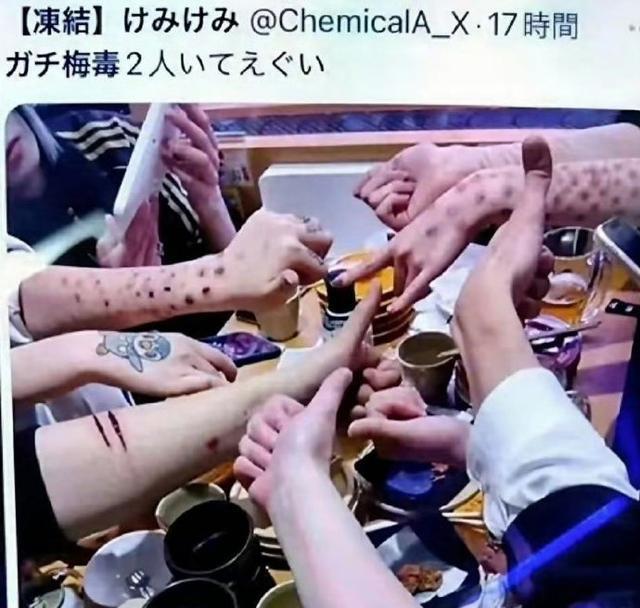 把梅毒当潮流？日本年轻人的“病态狂欢”警醒所有人
 
日本梅毒确诊数连续4年超1