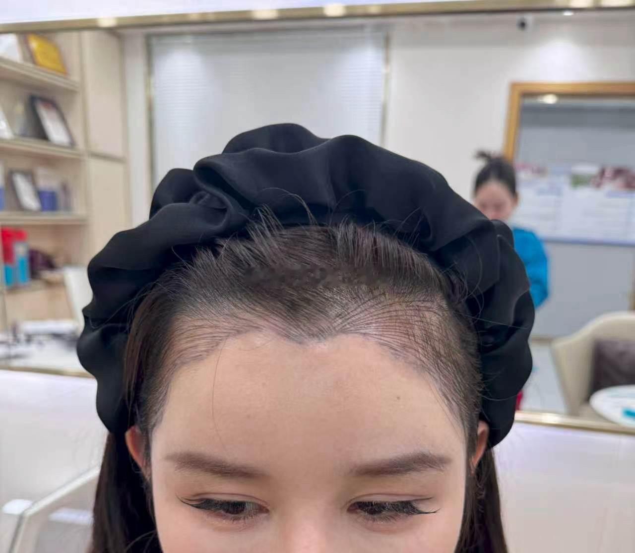 发型就是女生最好的医美，一转眼做完半年多啦很喜欢，最近拍的美照来咯