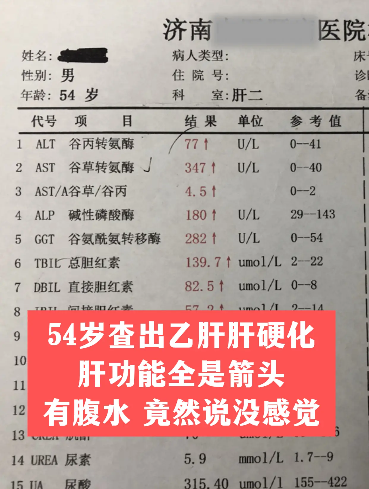 门诊来了位河南的患者，今年54岁，乙肝查出来10多年，从来没管过，也没...