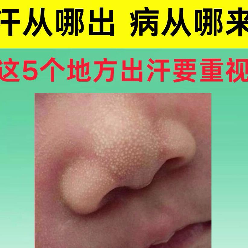 汗从哪出病从哪来，这5个地方出汗要重视。
·1.腋下出汗肝胆湿热。如果你是腋下经