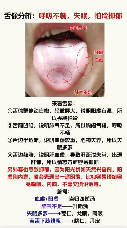 舌象分析