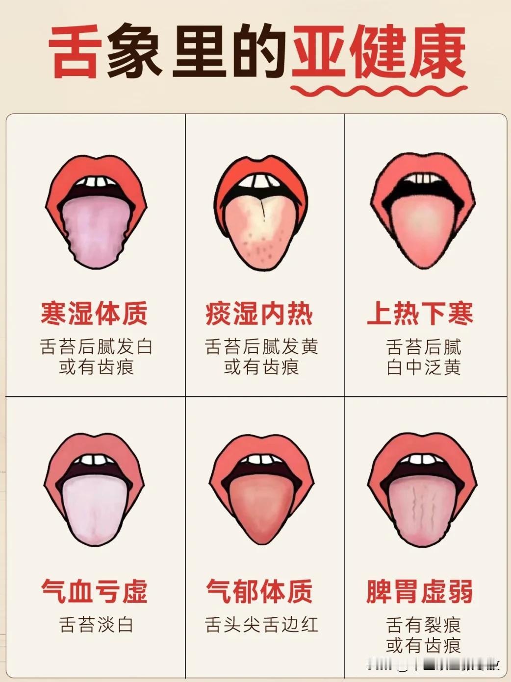 藏在舌头舌苔里的亚健康❗️❗️你亚健康了嘛🔥

学会看舌苔才能找准对应的调理方