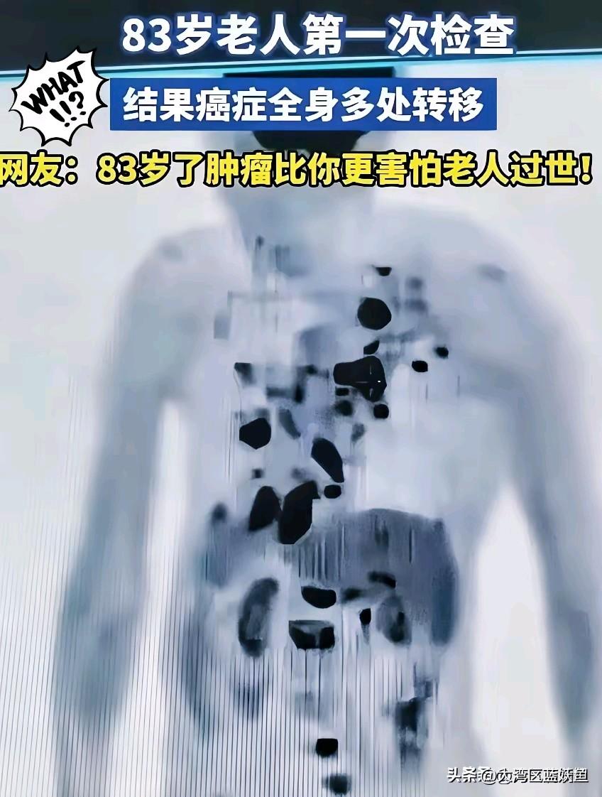 安徽那位83岁老人的事，看完鼻子有点酸。
 
儿女硬拉着他去体检时，老人还嘟囔“