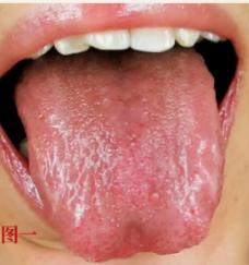 体质分九种，九种体质，九个药，想养生，先学会区分自己属于什么体质！
 
1.气虚