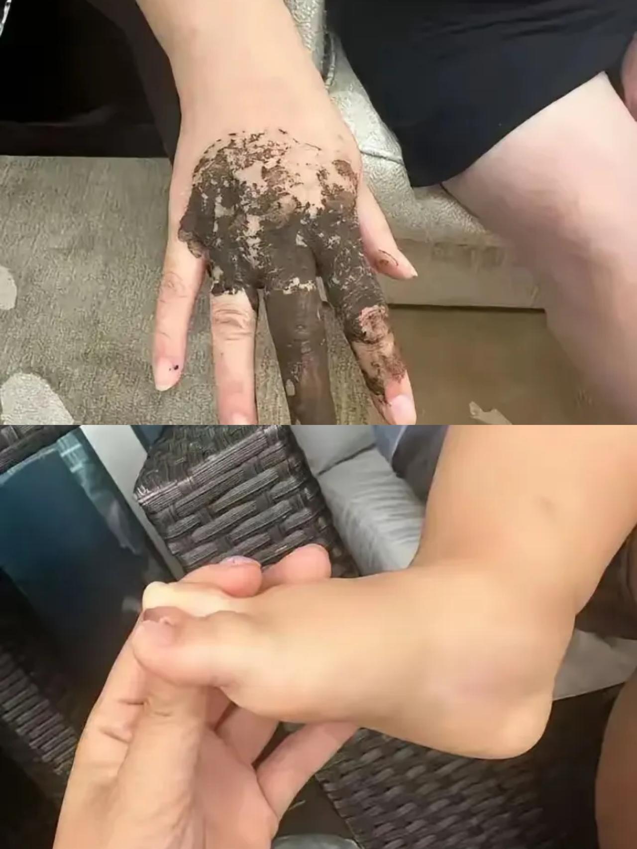 “悲剧还是发生了”
 
海南三亚有位奶奶带孙女在酒店游泳，上岸发现娃脚上爬着大黑