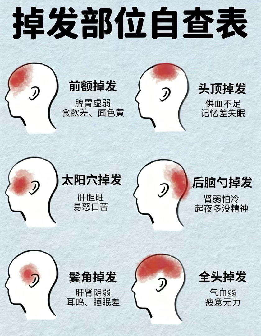 掉发部位自查表1、脾胃虚弱怎么办？如暂时胃胀、隐痛，切莫揉按腹部（加重不适）。正