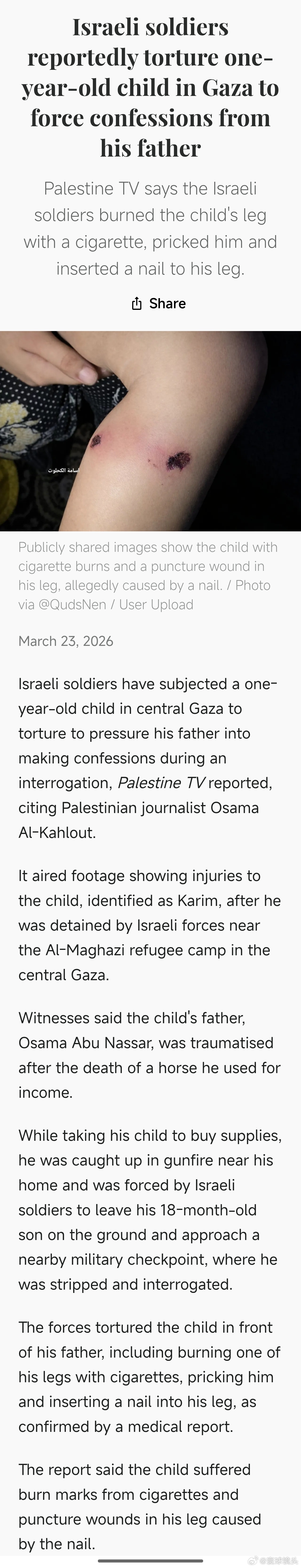 以军对18个月大婴儿施酷刑以色列人真的是一遍遍刷新人类的底线，简直就是新时代的日