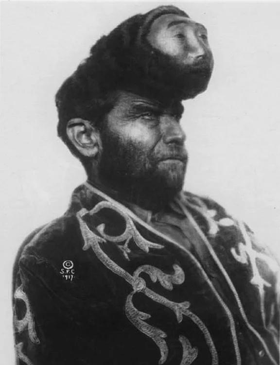 帕斯夸尔·皮尼翁（1889-1929），又名“双头墨西哥人”。他是20世纪初塞尔