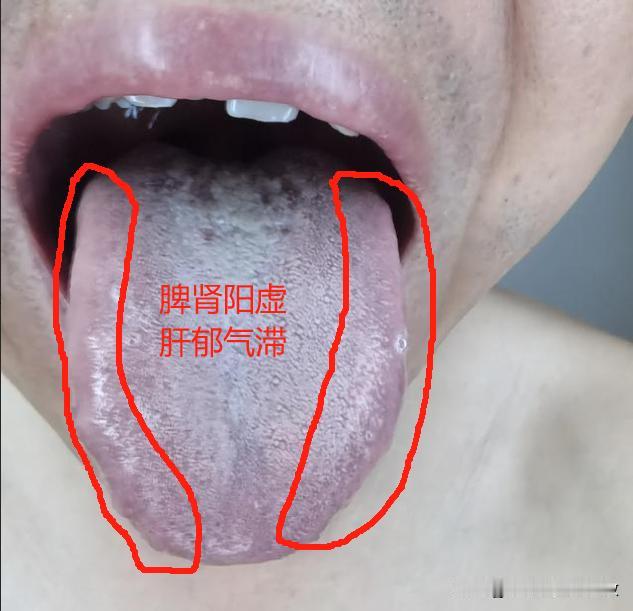 说了一遍，又一遍，那真是一点不当回事，真无语了[黑线][黑线][黑线]
主诉：感