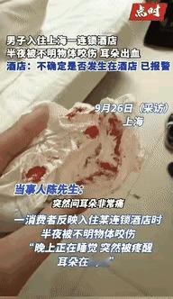 太离谱了！
 
上海大哥住酒店睡个觉，耳朵突然剧痛，开灯一看满手是血，医生都说是