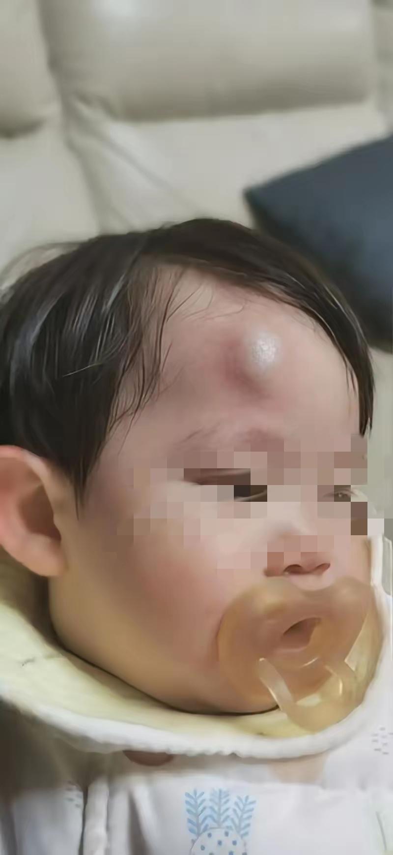 儿媳妇说，婆婆看孩子没有尽到责任，孩子头上磕了一个大包，真不想让婆婆再看孩子，想