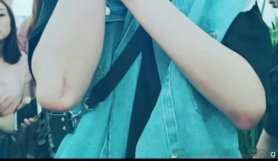 摩登兄弟 呜呜呜呜呜呜好长一道疤