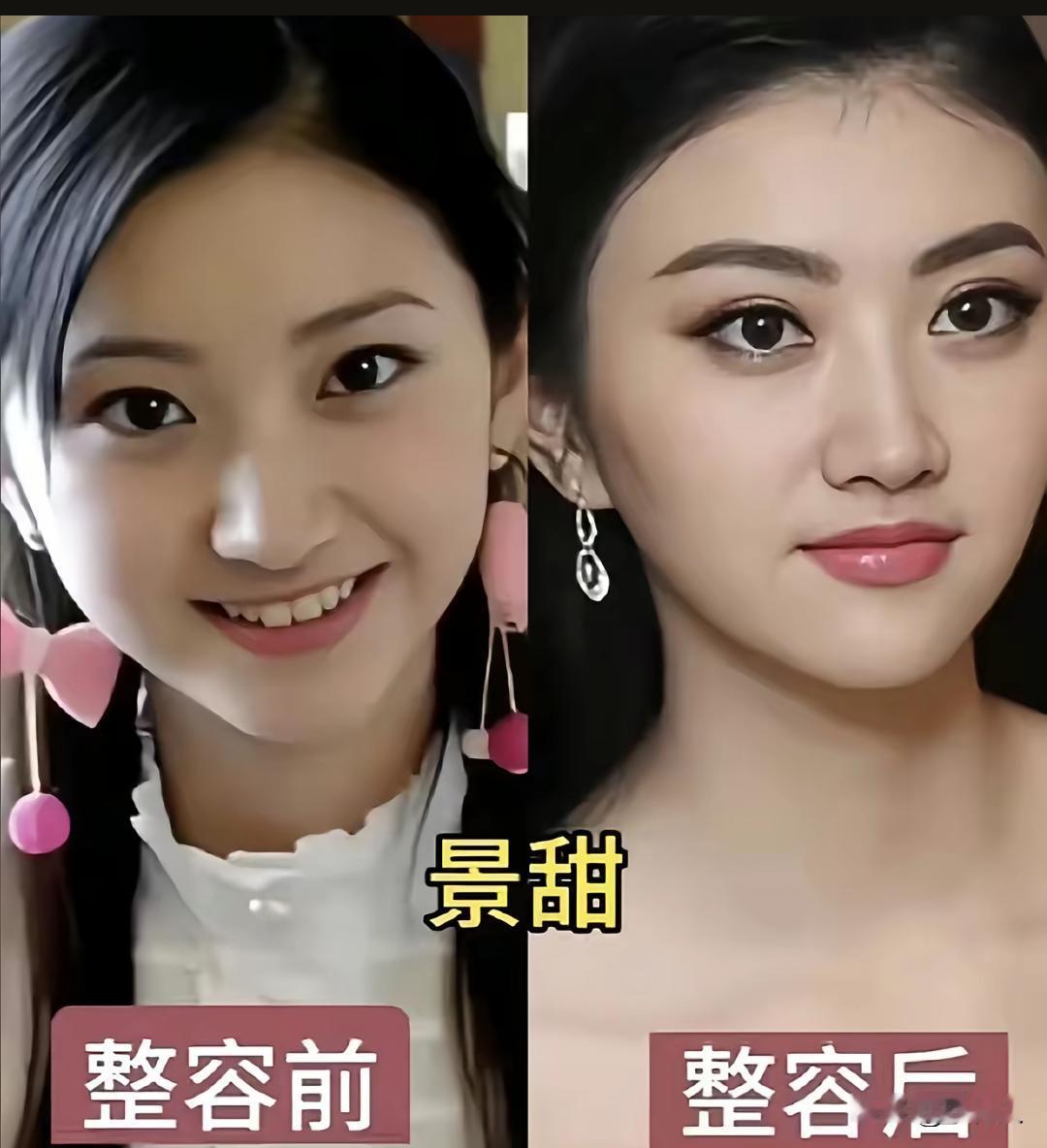 景甜整不整容，基本上没什么区别。她应该算是微整，景甜这么漂亮其实不用整容。
景甜
