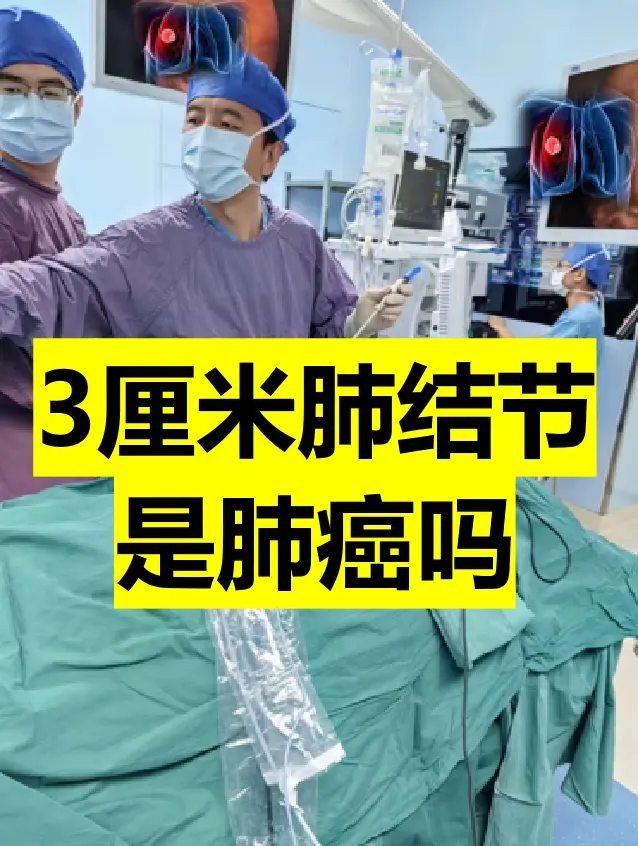 体检发现3厘米肺结节，怀疑肺癌，是癌吗。一位女性患者来门诊找我看肺结节...