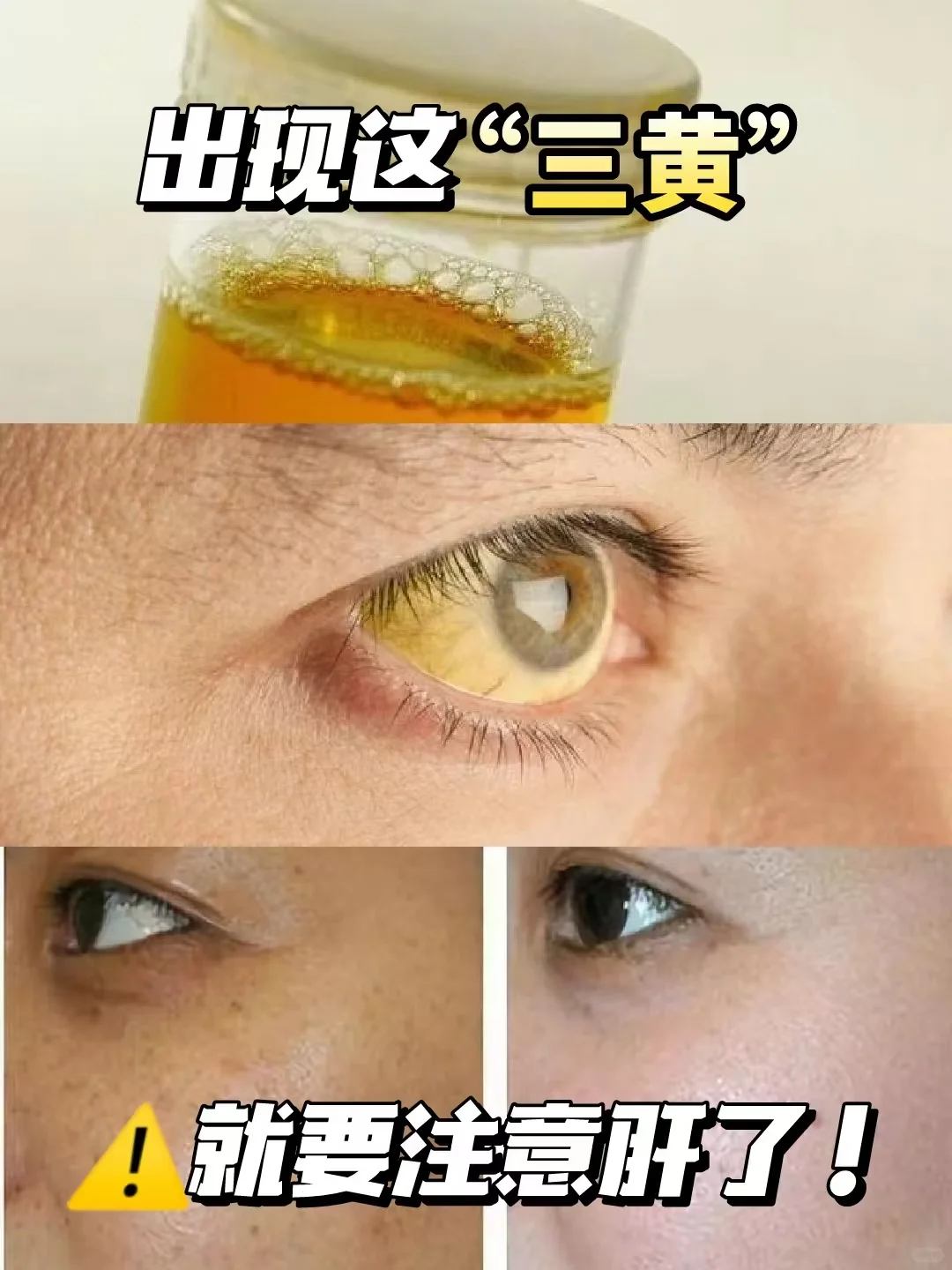身体出现这“三黄”一定要注意！！！
