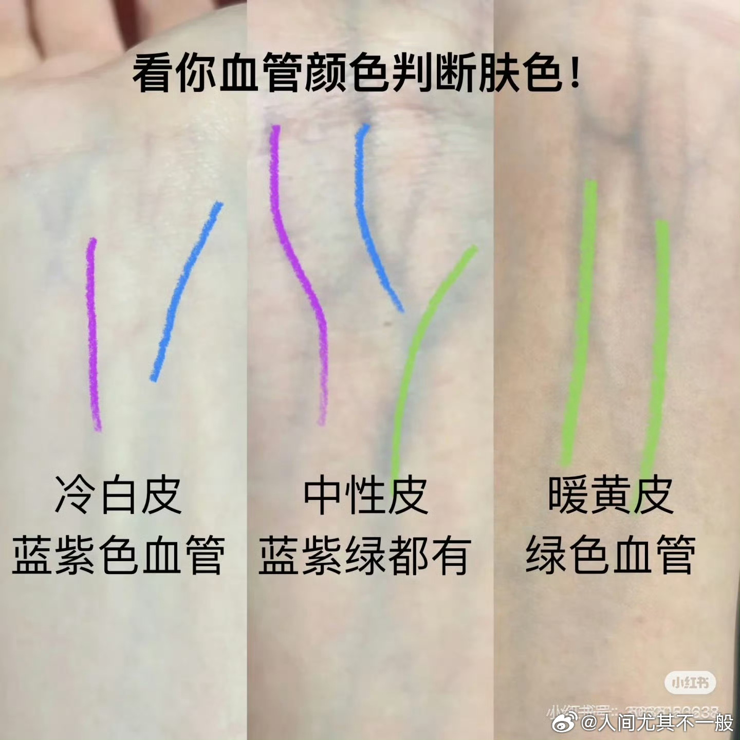一个“黄一白” 变白的极佳反馈案例。圆身就是容易气血不足+肝气郁结，因此肤色暗+