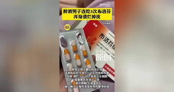 男子酒后头痛连吃3次布洛芬，全身溃烂确诊重症药疹