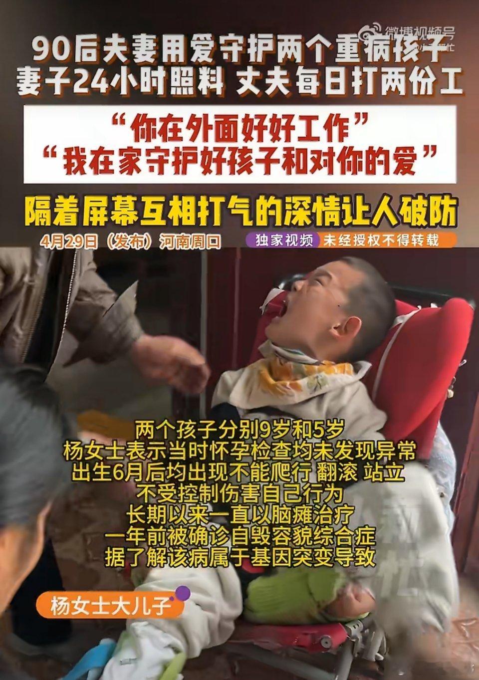 妈妈回应兄弟俩患自毁容貌综合征河南周口一对90后夫妻的两个儿子，双双确诊罕见自毁