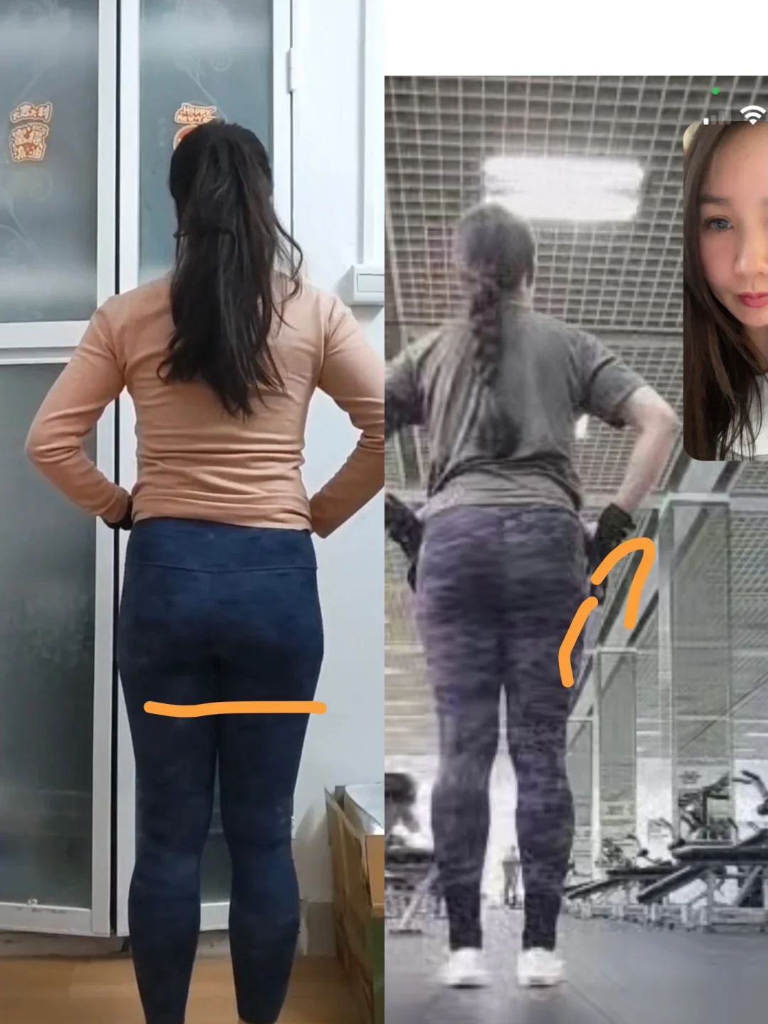 线上臀部对比