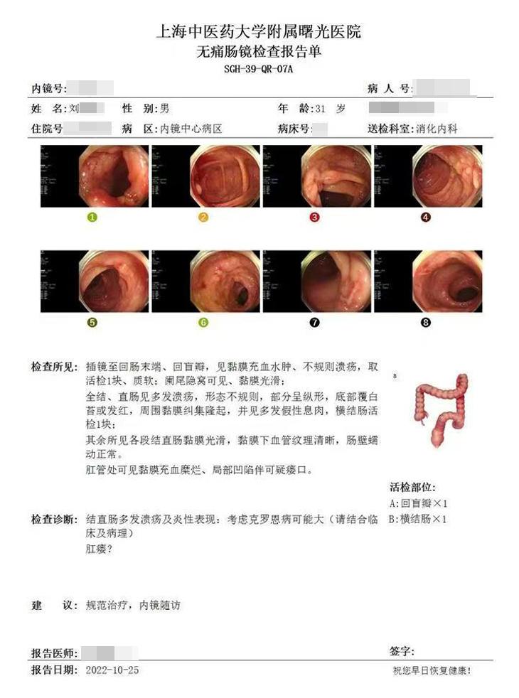 克罗恩病缓解期不是梦！。4 年康复经验：这 3 个关键点缺一不可！ 这...
