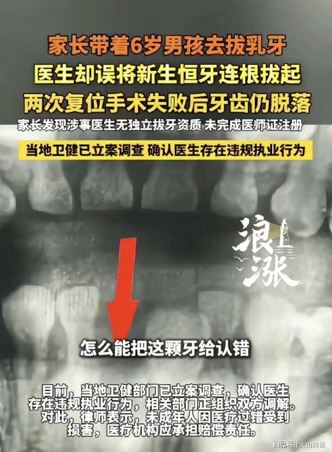 这样医生竟然敢行医？江苏李女士带6岁儿子去拔乳牙，拔完牙回家一看，医生把两颗刚长