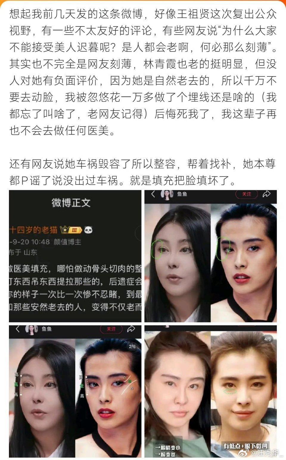 不求满满的胶原蛋白，但是也别满满的玻尿酸呀！王祖贤称60岁还被议论容貌王祖贤 复