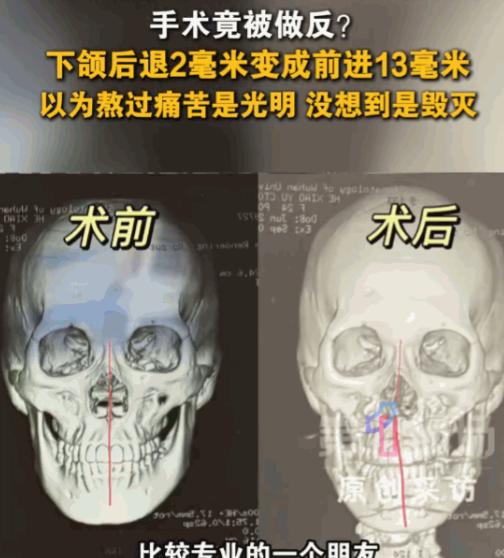 万万没想到！湖北武汉，24岁女子满心欢喜地躺上手术台，本想通过一场微调手术告别那