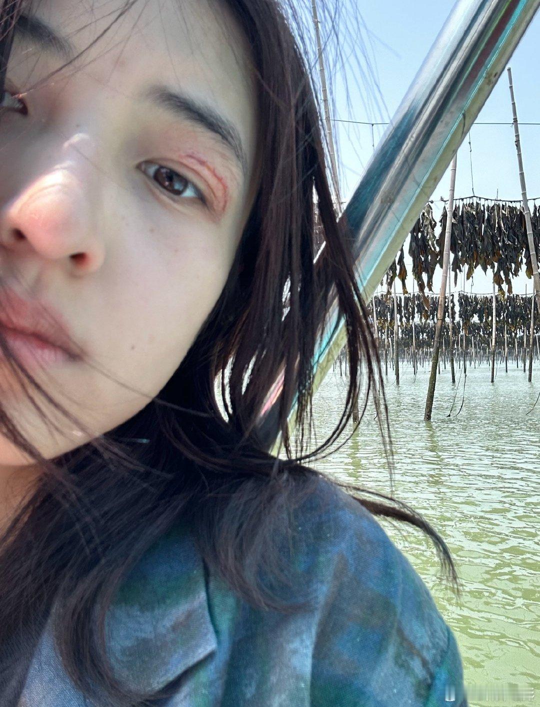 张子枫有树林的海 张子枫海边自拍，眼睛受伤妆是电影《下一个台风》的林沫沫~张子枫