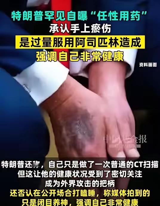 网上有人给特郎普算了一卦，说他活不过1月20日，希望如此吧！