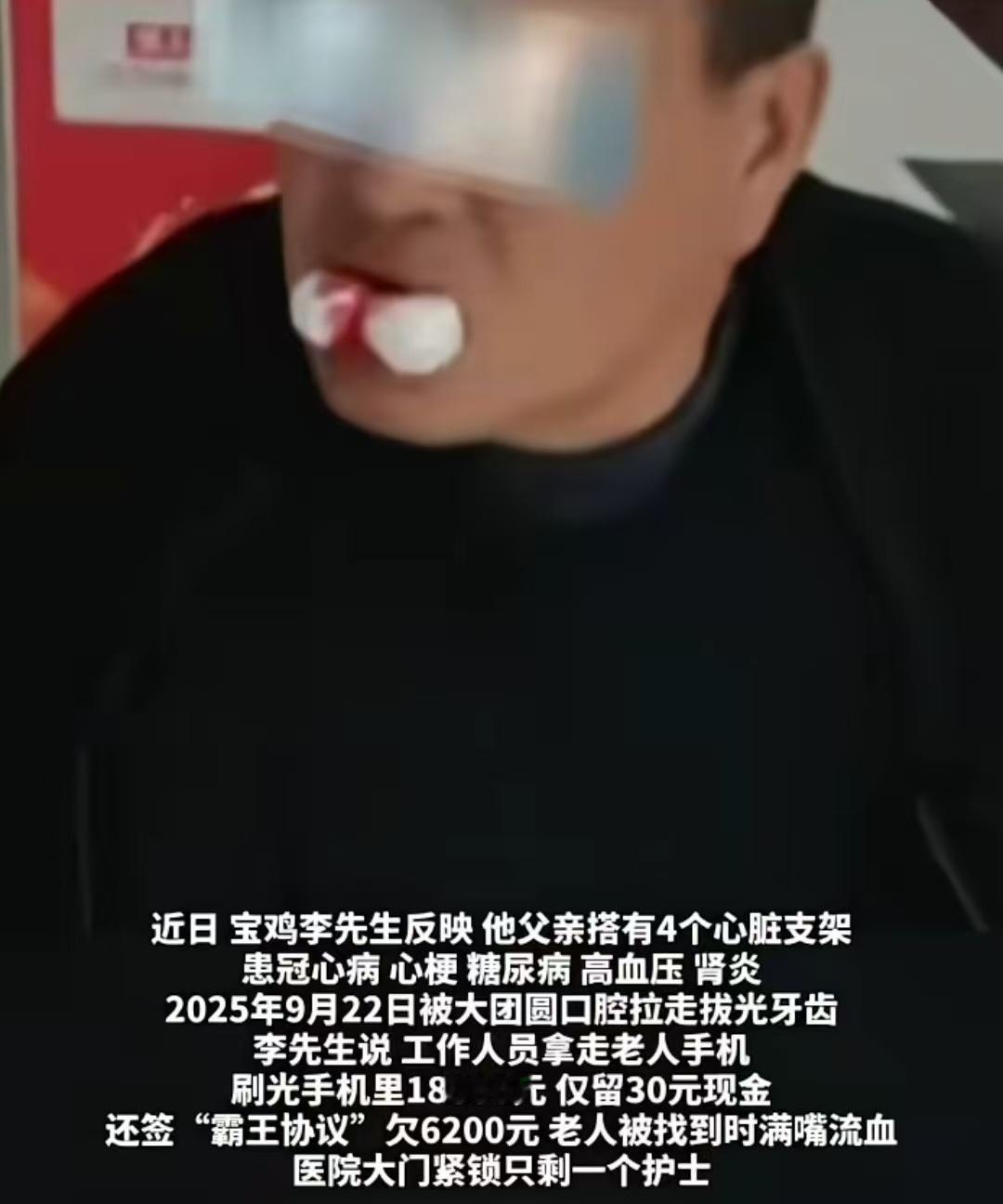 63岁老人被口腔医院拉走拔光全嘴牙齿，刷光所有积蓄，还倒欠6200元。李先生称，