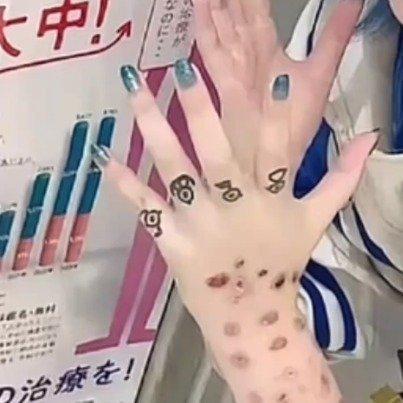 日本这梅毒感染情况太离谱了。数据显示，2022 年日本梅毒感染病例首破 1 万，