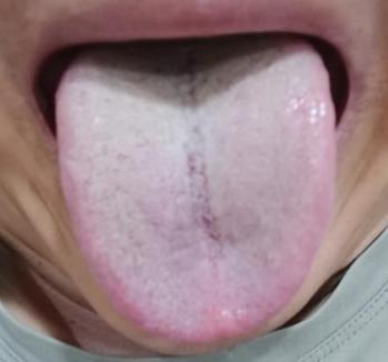 这个小伙很明显就是乱吃药的下场，找不到病根，想调理真是难上加难！

先看患者主要