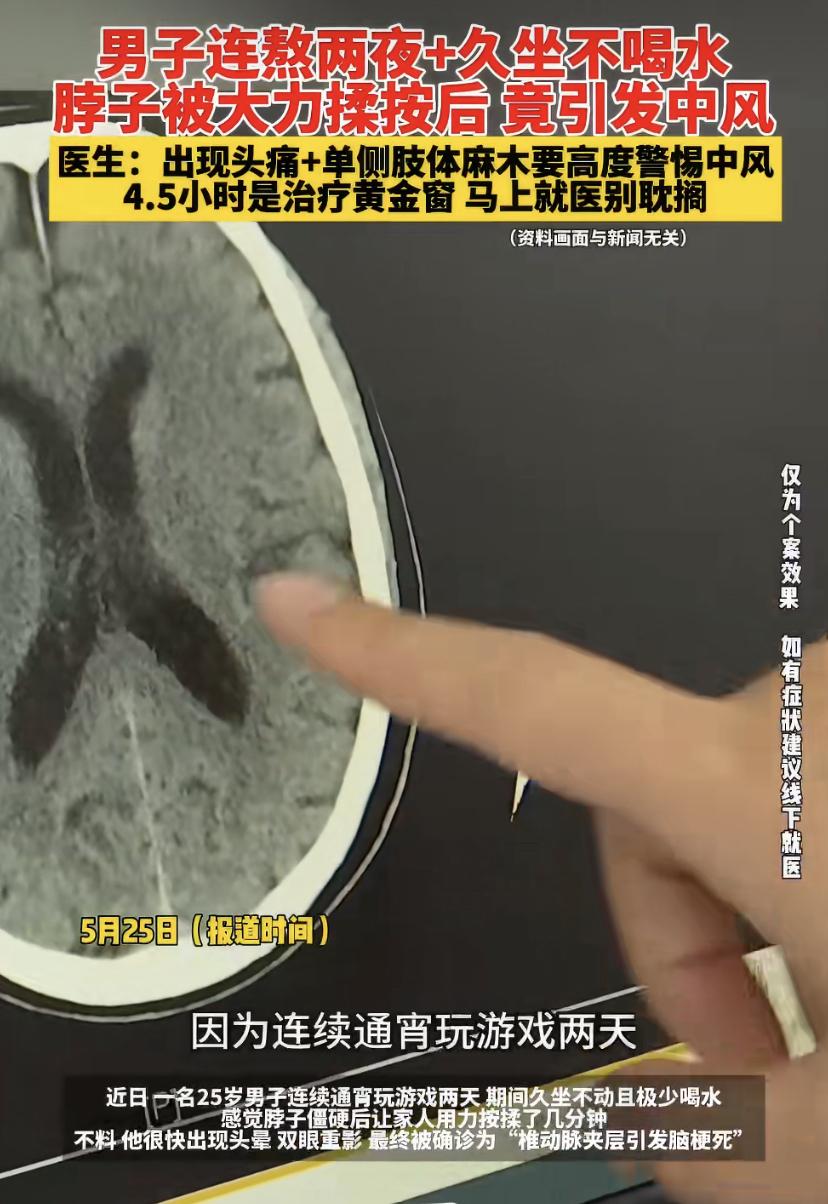 25岁小伙通宵打游戏两天，脖子不舒服让家人按了几下，结果直接中风了!
福建一个男