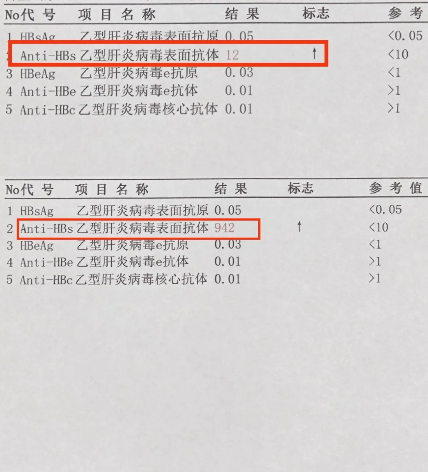 乙肝表面抗体越高，不得乙肝的几率越大！ 大家好，我是山东陈士俊医生，擅...