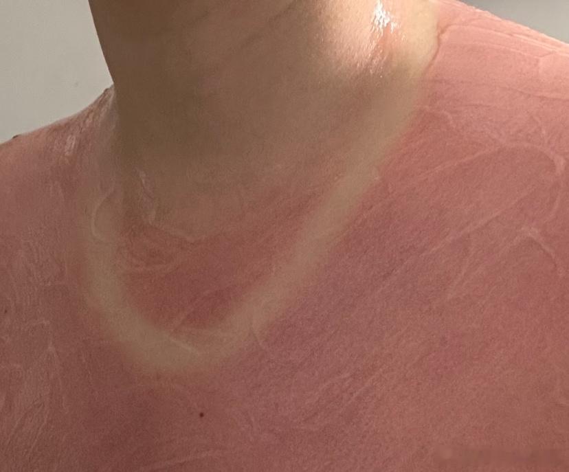 千万别听阴天没太阳阴天才更要防晒，你们有没有觉得阴天也会把脸晒得红彤彤的？虽然说
