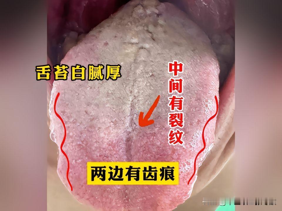 广西北海李先生，32岁，欲望非常强，但是能力3分钟都不到
想要调理，又不好意思医