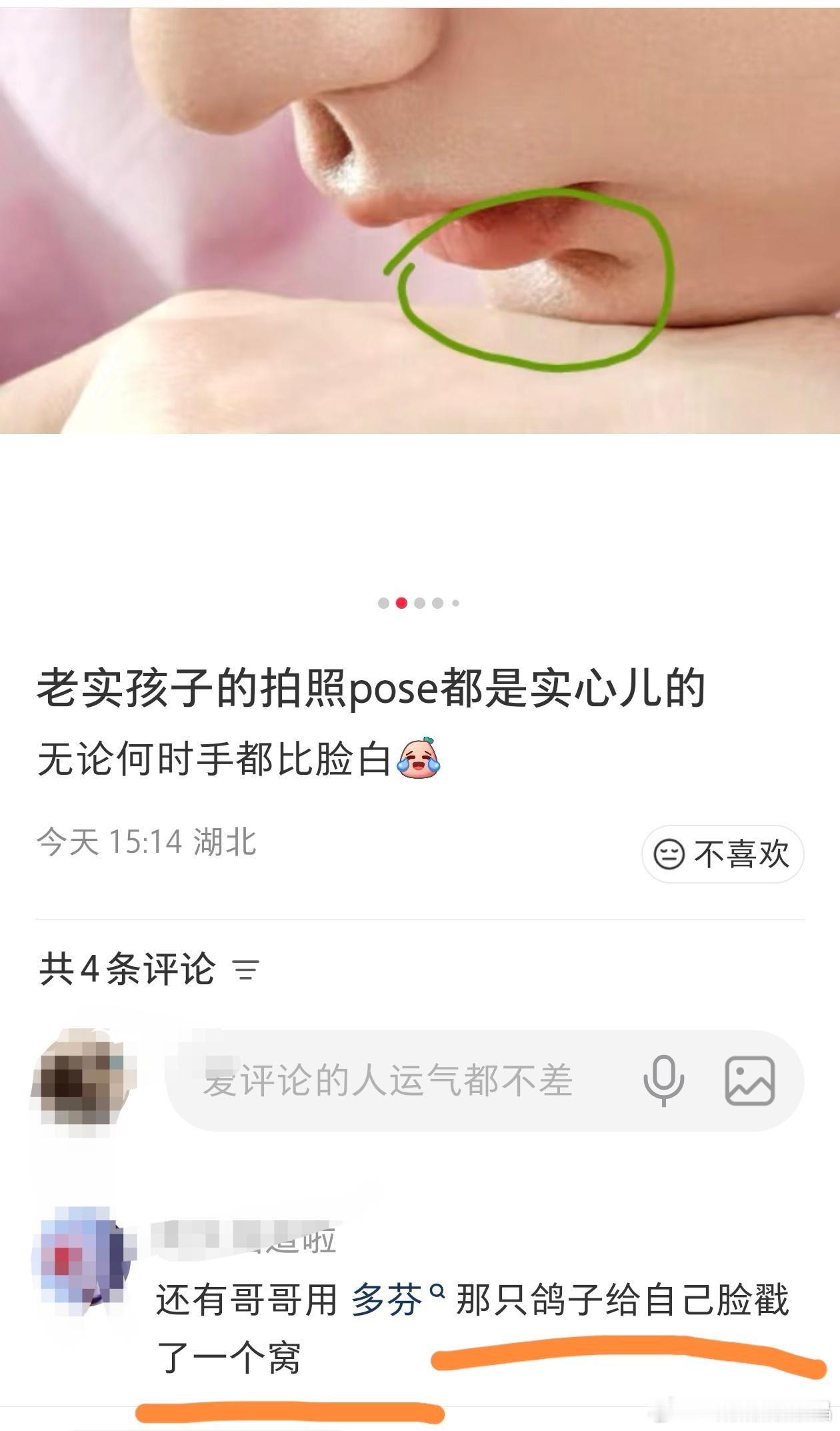 脸上能戳一个窝，水肿这么厉害？下巴怎么没了？ 