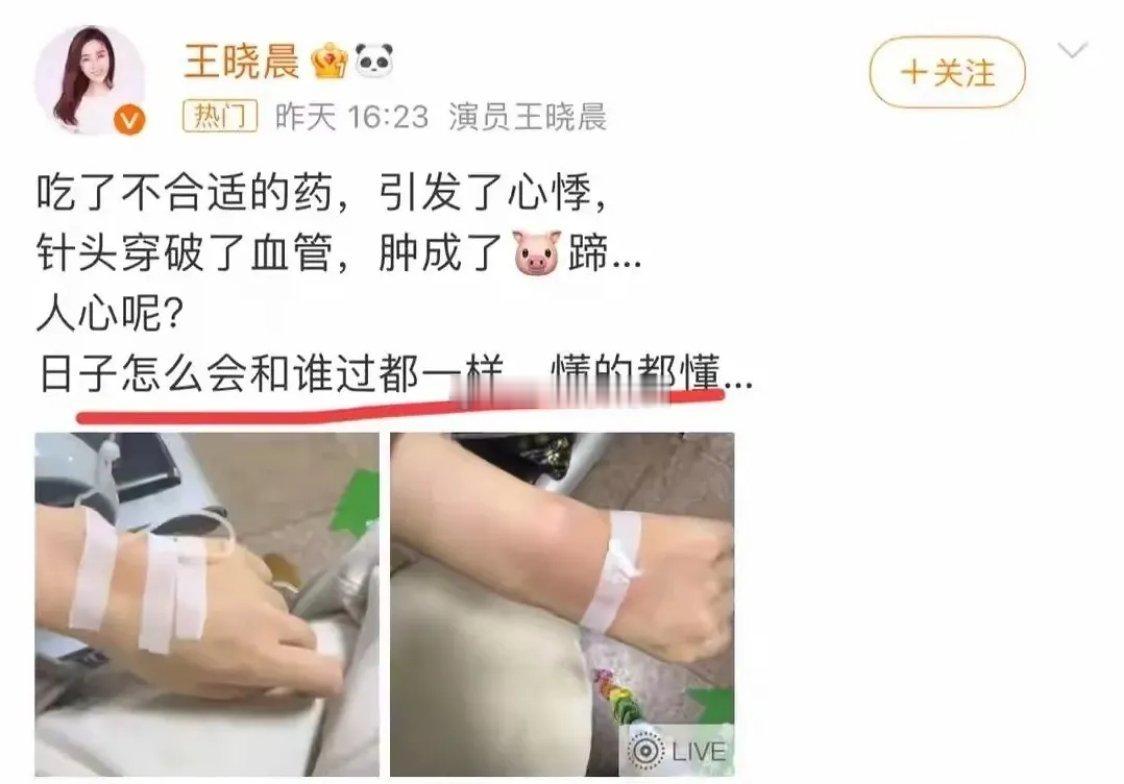 王晓晨俞灏明旧事再引热议！过度矫情真的败好感😮💨看王晓晨这事儿真的感慨，找伴