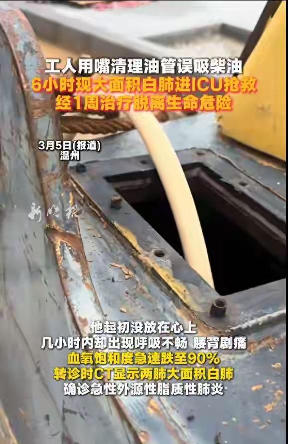 太惊险！温州48岁修路工为省事用嘴虹吸油管清柴油，误吸一口后没当回事，6小时就呼
