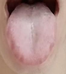 命门火衰易致虚阳上浮，体质虚寒人群分享温阳固元的调养思路








一位年