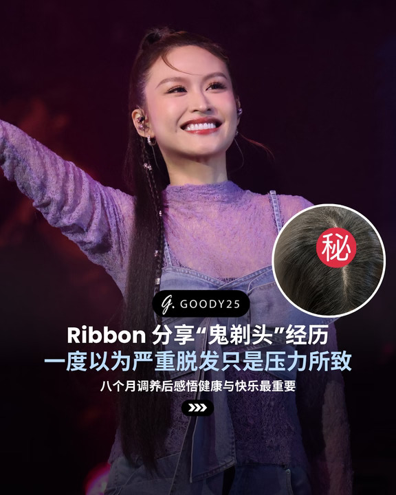 Ribbon 分享“鬼剃头”经历
