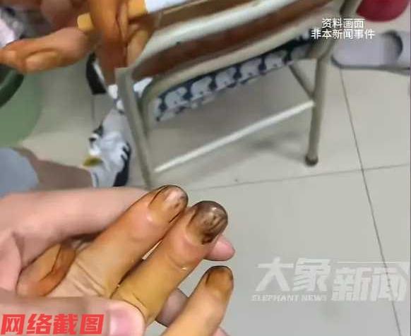 河南郑州有二十二岁男子就有十年的吸烟历史，这十年的过程里，如今却带给他身体健康的