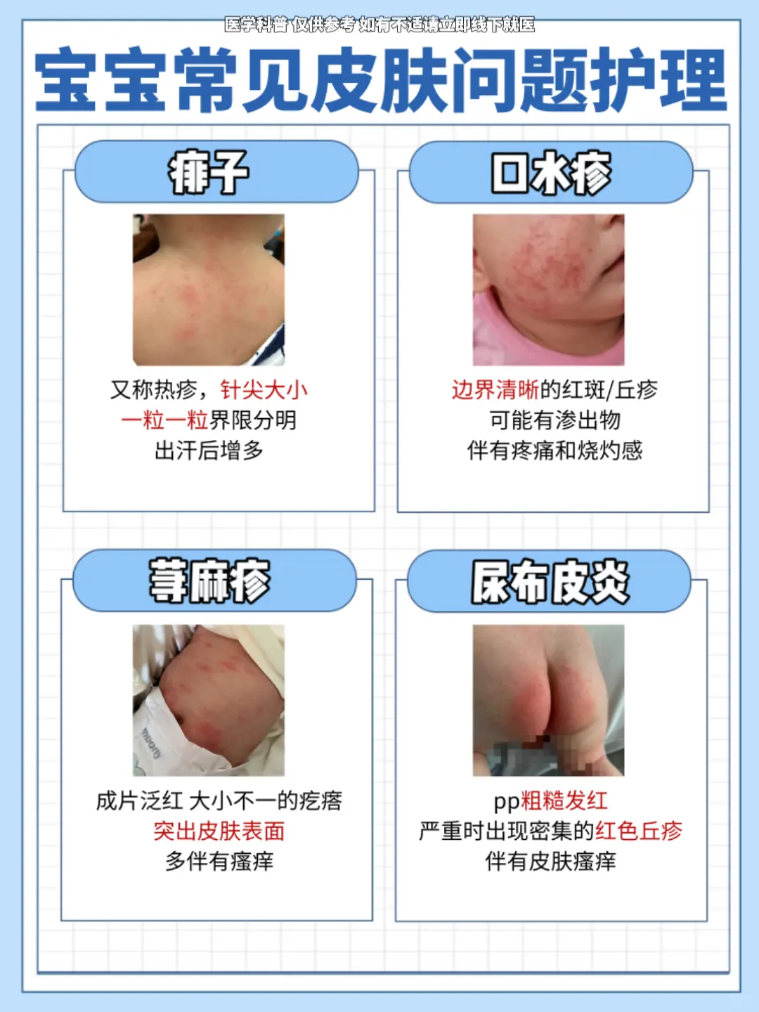 宝妈必看！宝宝常见皮肤问题合集~。