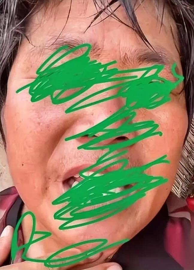 九旬老头摊上事了！

住院后竟有人上门求情？

院子里的叔叔最近查清一桩离谱事：