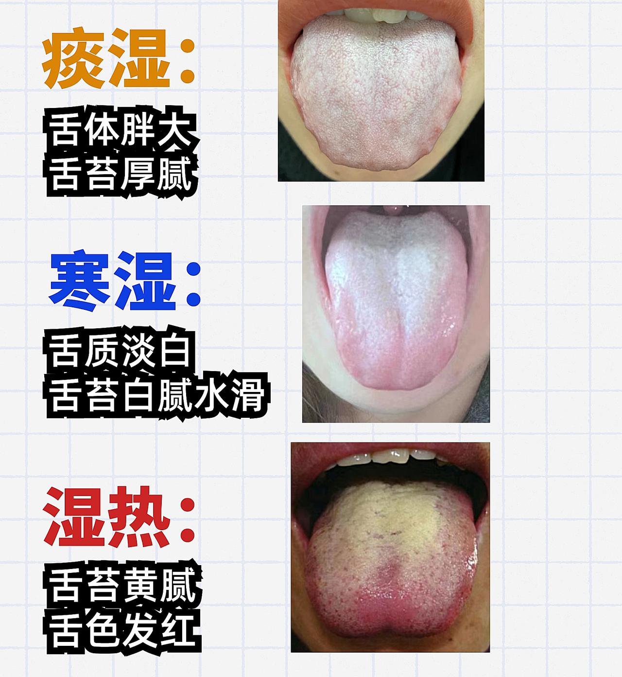 痰湿重的人痰多，寒湿重的人怕冷，湿热重的人发臭，三招全搞定

1.痰湿重痰多
脾