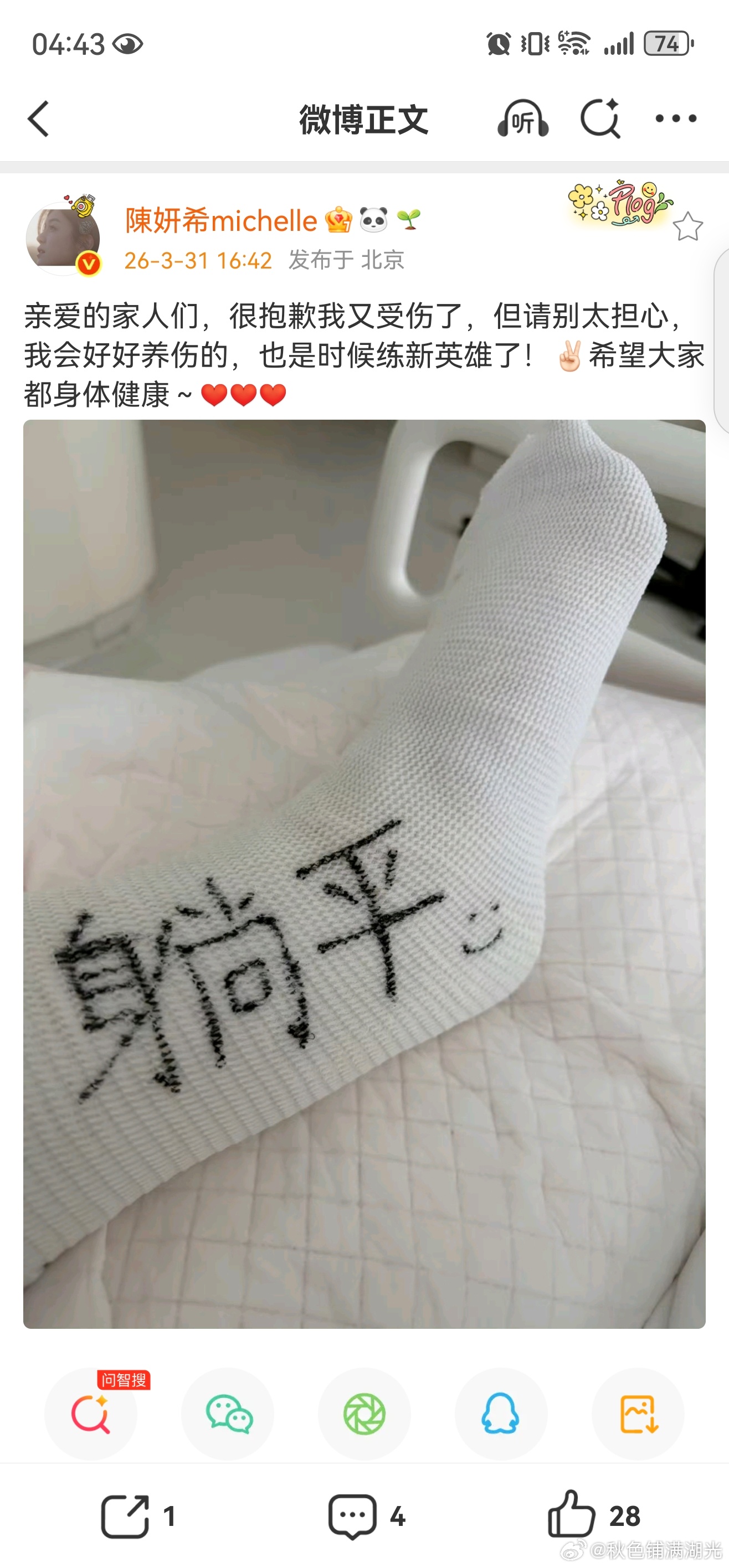 陈妍希又受伤了 陈妍希 