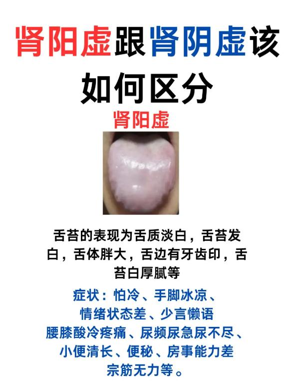 肾阳虚和肾阴虚，一张舌象图教你分清